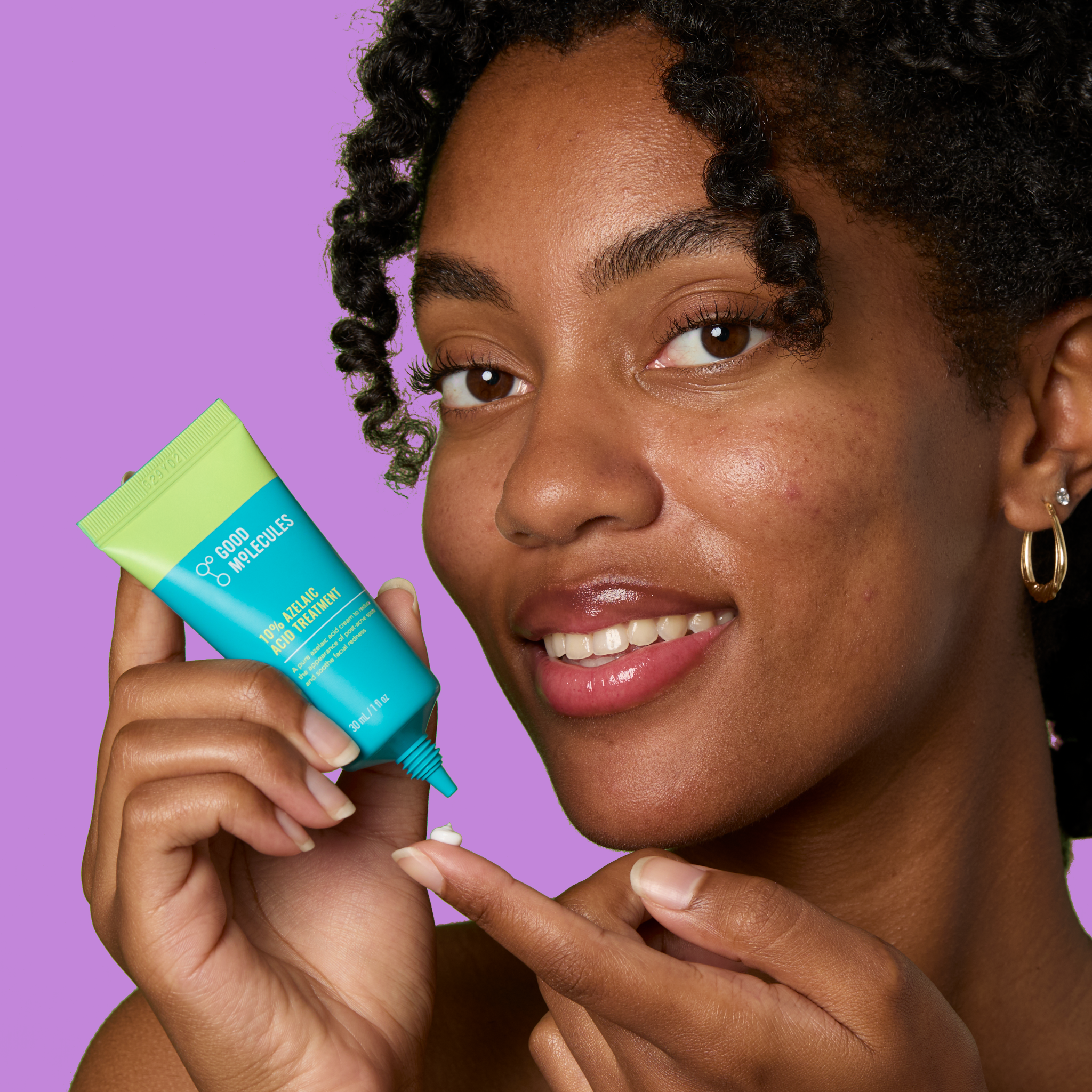 10% Azelaic Acid Treatment